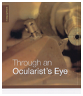 Through an Ocularist's Eye from Mivision