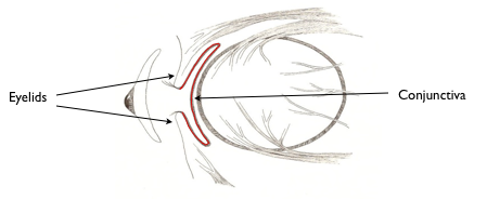 The conjunctiva is sutured to enclose the orbital implant.