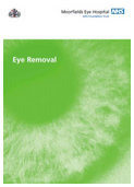 Eye Loss from the Moorfields Eye Hospital